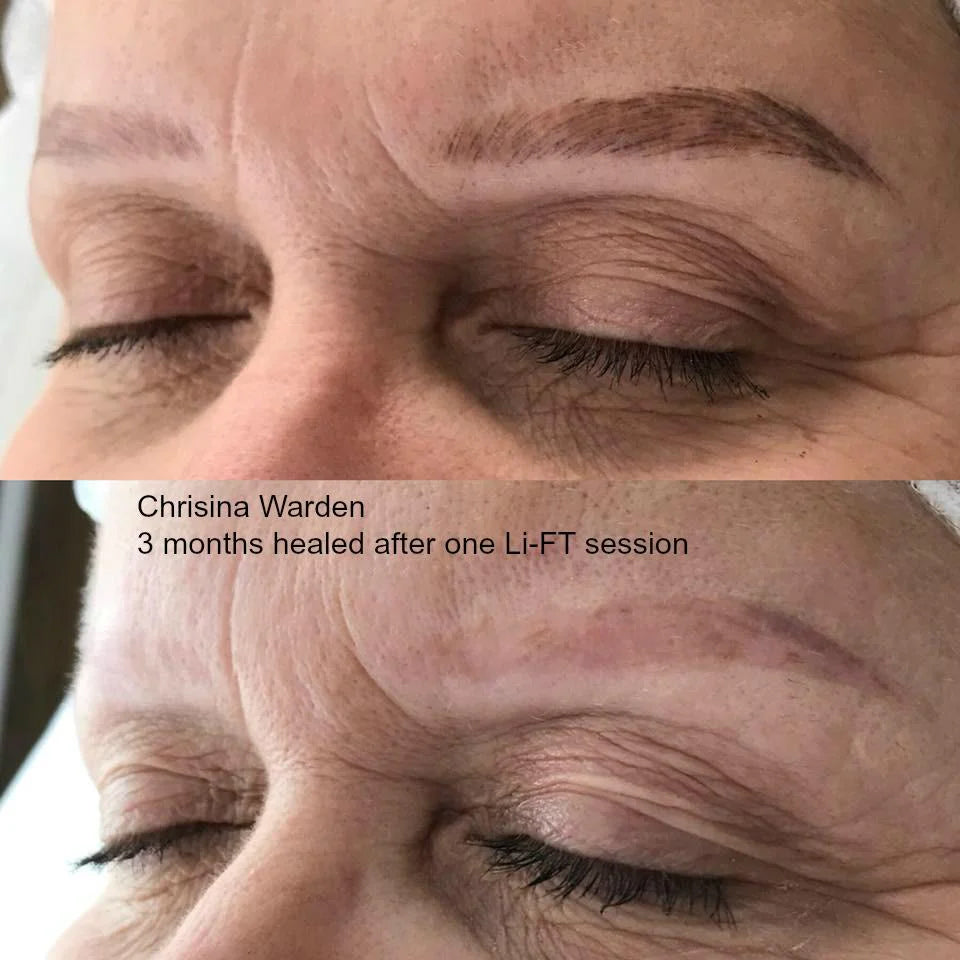 Li-FT Solution Results